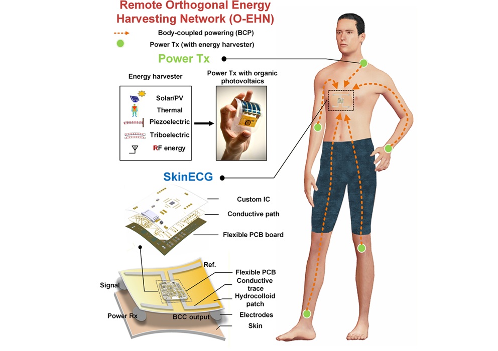 Imagen: Una ilustración del concepto SkinECG (Joanne Si Ying Tan et al. Science Advances, DOI:10.1126/sciadv.aec9803)